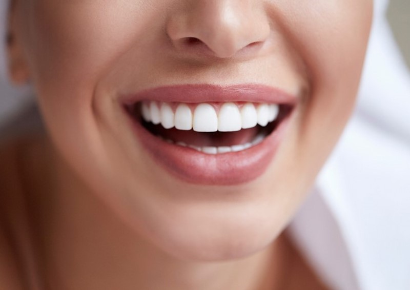 beljenje zob je najuspešnejše pri zobozdravniku